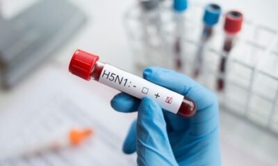 Bird Flu: An epidemic 100 times more dangerous than Corona can spread, experts expressed concern about this virus