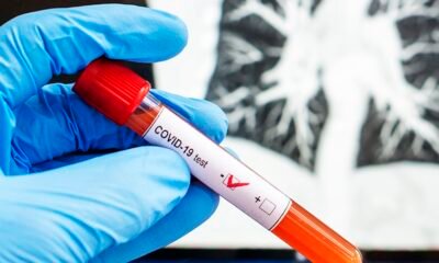 Covid-19: WHO took a big decision after seeing the speed of infection, active cases in India crossed 1000