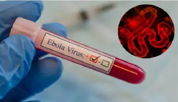 Congo Ebola Outbreak, Ebola Virus, WHO Global Health Emergency, Ituri Province, Bundibugyo Strain, Samuel Roger Kamba, Bunia, Ebola Deaths, Africa Health Crisis, World News
